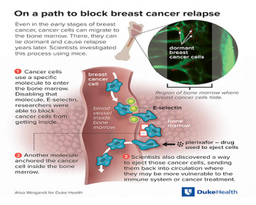 Scientists Block Breast Cancer Cells From Hiding in Bones