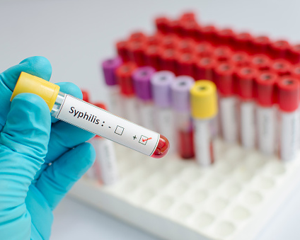 Duke Co-Leads International Research Effort to Develop Syphilis Vaccine ...