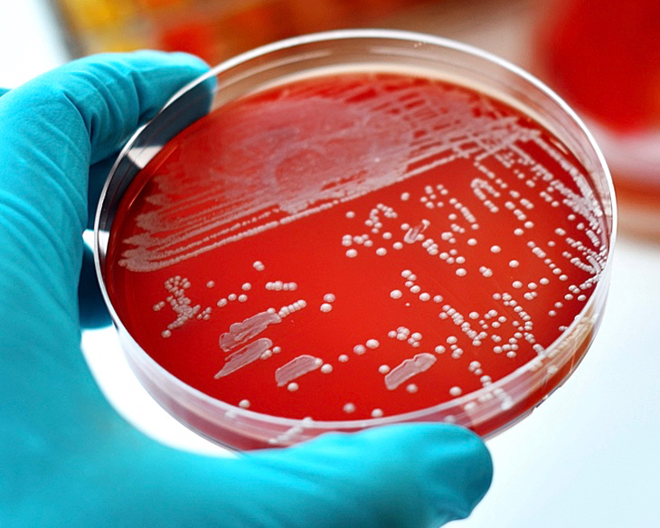Холера лабораторная. Пневмококк бактериологический метод. Лабораторная диагностика пневмококковой инфекции. Бактериологического исследования кожи.