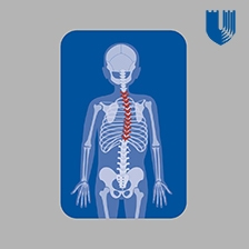 Xra image of scoliosis