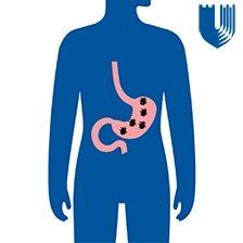 Illustration showing stomach