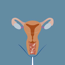 image of a uterus 
