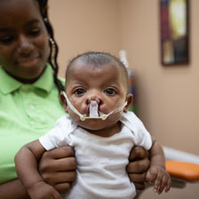 child with NAM device