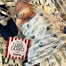 Baby Owen Monroe with chest closed sign and date