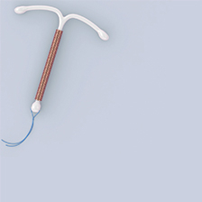 IUD 