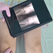 Caregiver holds iPad with x-rays of knees over patient.