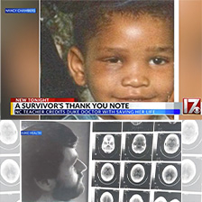 Child with eye injury above a man looking at X-rays of a human skull